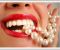 Доступные цены на протезирование в стоматологии "АКУС"